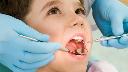 Çocuklarda Diş Çürüklerinden Korunma Yolları
