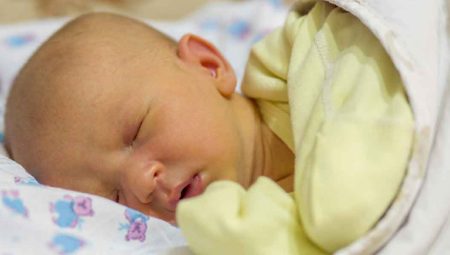Bebek Sarılığı Belirtileri Ve Tedavisi