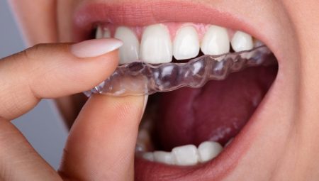 Diş Sıkma ve Gıcırdatma Hastalığı