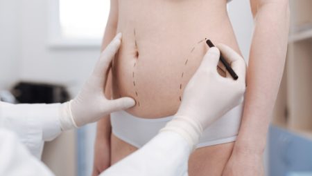 Geleneksek Liposuction Ameliyatı