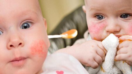 Alerji olan bebek ne yemeli? Alerjik bebekler için alternatif besinler nelerdir?